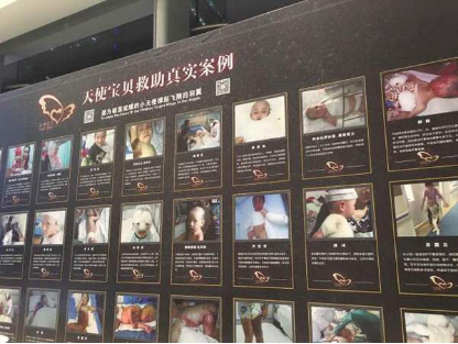 ��ATTOS�����԰�֮����Ϊ��������